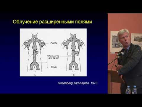 Птушкин В.В. - Эволюция терапии лимфомы Ходжкина.