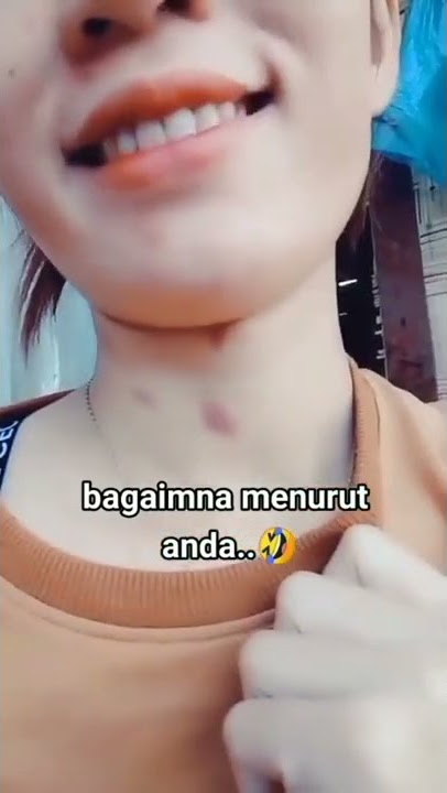 Bekas Digigit Nyamuk Kali ya #shorts #tiktok #viral #lucu