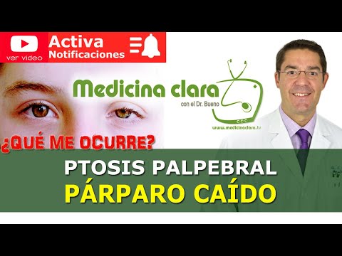 Ptosis palpebral o Párpado caído | Medicina Clara