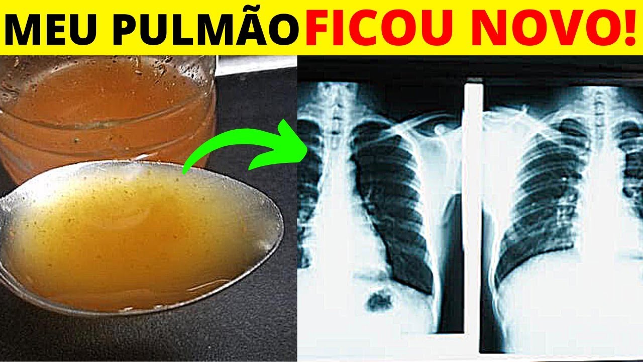 Como Limpar O Pulmão - RETOEDU