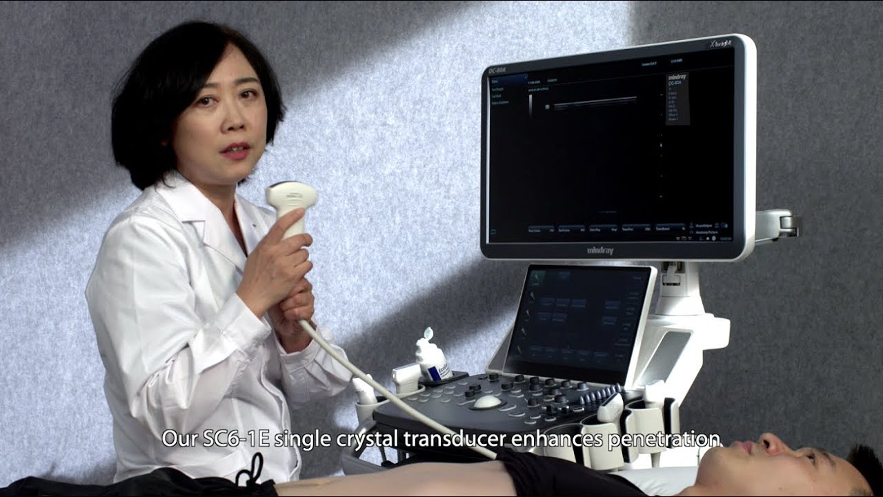 Mindray-DC-80A with X-Insight Demonstration