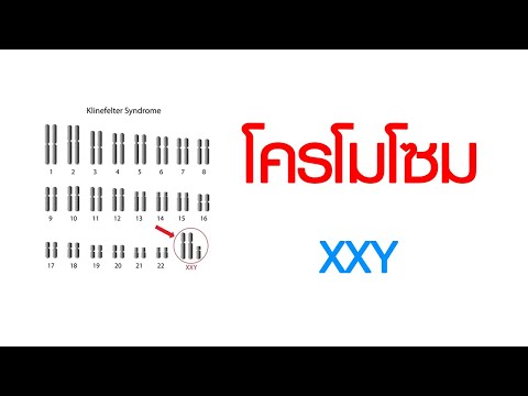 วีดีโอ: คุณรู้ได้อย่างไรว่าคุณมีอาการ XYY?