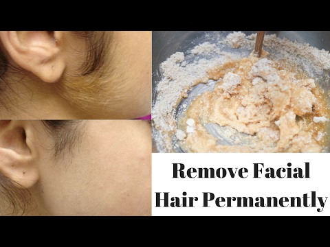 How To Remove Facial Hair Permanently & Naturally | Removes Acne, Acne Scars & Dark Spots