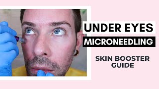 How To Microneedle Under Eye With PDRN Skin Booster | Curenex With Dr Pen Ft @Vanidiy