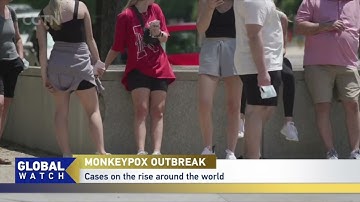 MONKEYPOX OUTBREAK -- WHO: Spread highly likely in future