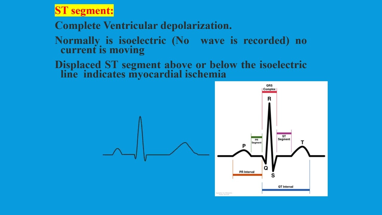 ELECTROCARDIOGRAM ECG  Simplified part 2