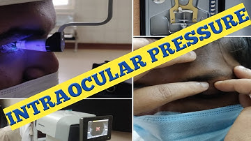 INTRA OCULAR PRESSURE/TONOMETRY/schiotz tonometer/ Goldmann Applanation / Tonopen/Noncontact /Pascal