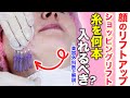 【リフトアップ 整形】ショッピングリフト何本入れるべき？医師が徹底解説