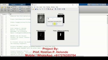 Image Segmentation Using Fuzzy C Means Clustering