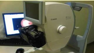 An Intro to Dr. Colin K. Chan - Toronto Optometrist