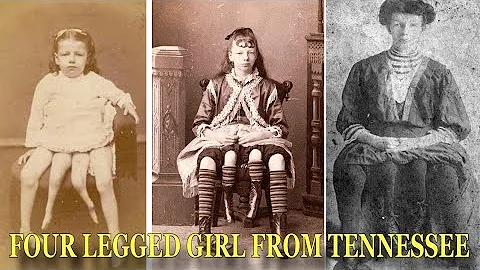 Life of Four Legged Girl From Tennessee 'Josephine...