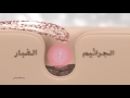 ديتول تنظيف عميق