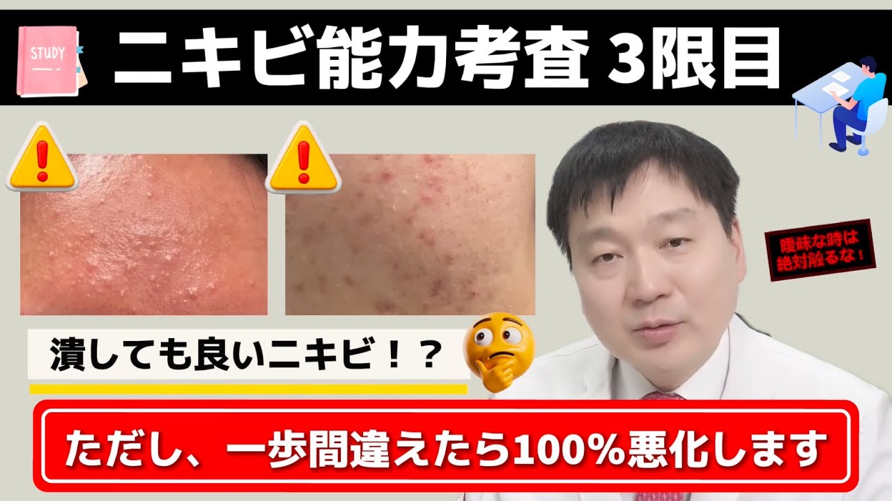 【ニキビ能力考査 3限目】 このニキビは排出させてもOK👍ただし一歩間違えたら大惨事です🥲症例付きで解説します☑️