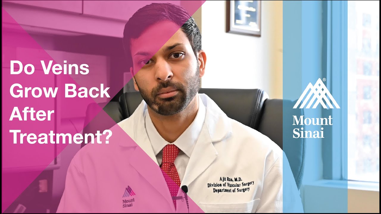 Ask the Expert: Do Veins Grow Back After Treatment 