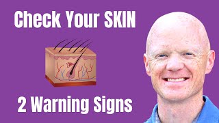 2 Signs YOU May Have Insulin Resistance [Dr. Ben Bikman, PhD]