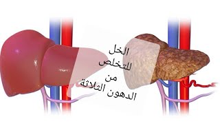 الطريقة الصحيحة لإستخدام الخل لتطهير الجسم من السموم و الدهون الثلاثية.