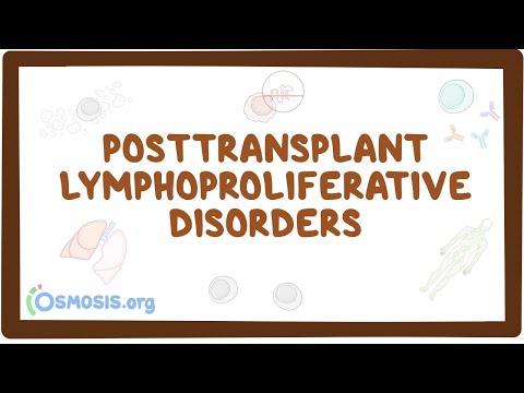 Posttransplant lymphoproliferative disorders - causes, symptoms, diagnosis, treatment, pathology