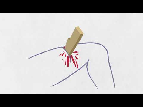 Video: Sådan forbinder du et sår under førstehjælp: Stop blødning, infektion