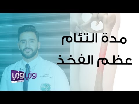 فيديو: 4 طرق للتعافي من كسر الورك