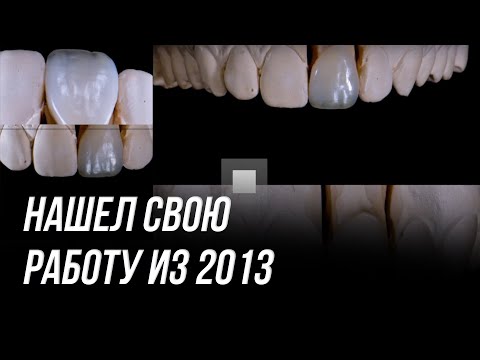 Зубной техник обучение с нуля. Моя работа с 2013 года. Как я научился работать сам зубным техником