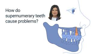 Supernumerary tooth Net Worth