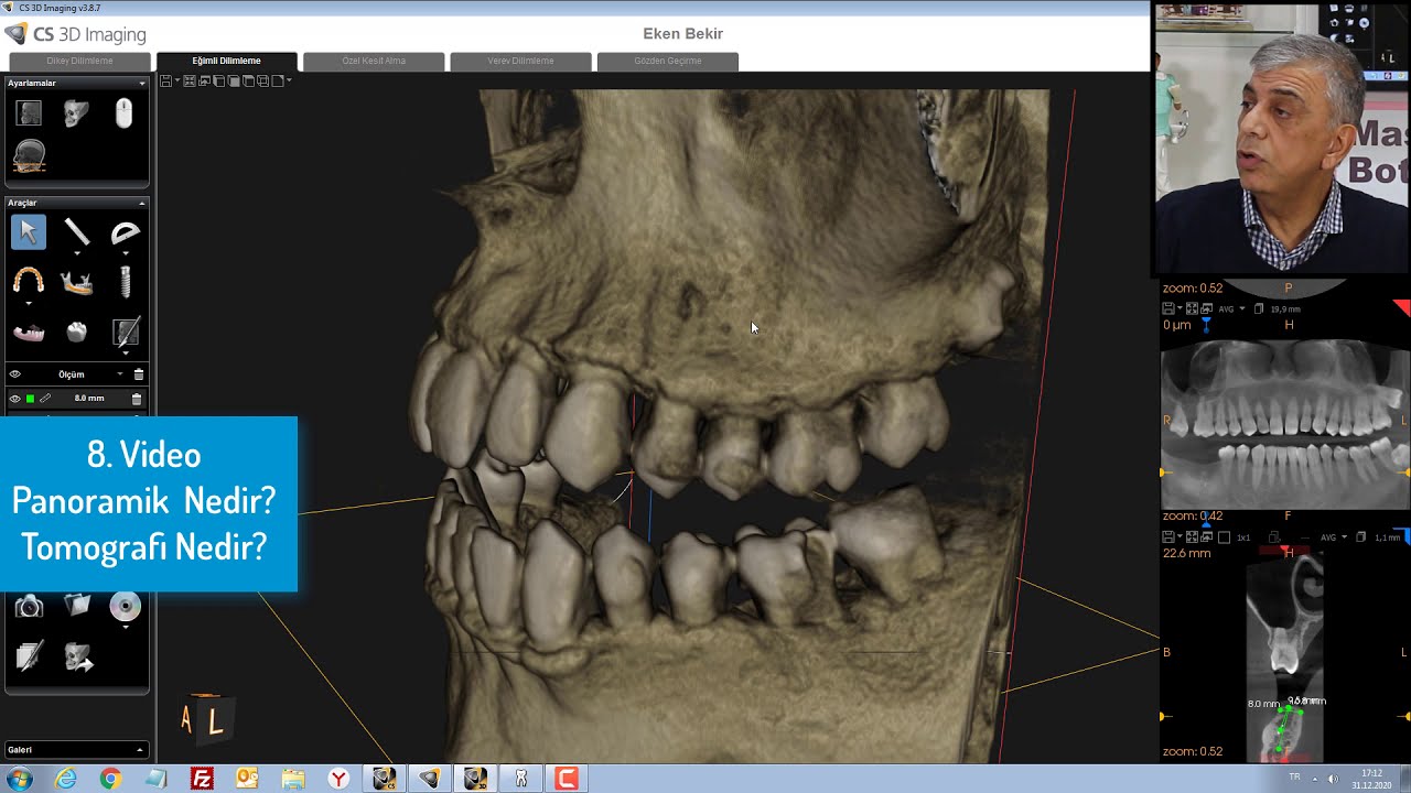 8.Video-Panoramik Röntgen Nedir? Tomografi Nedir