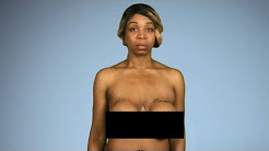 Tiffany 'New York' Pollard Gets Deformed Breast Implants Fixed