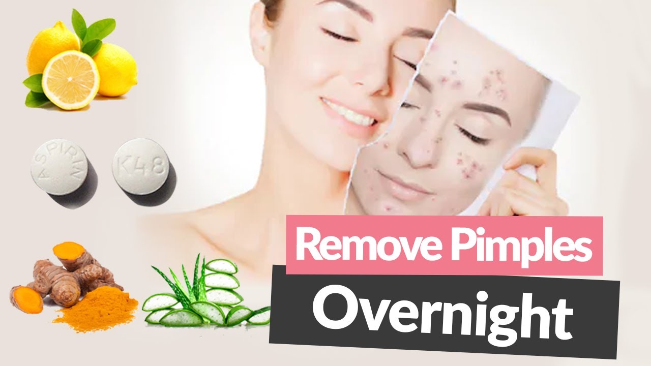 How To Remove Pimples Overnight | Acne Treatment |2020 - YouTube