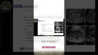 Detect Kidney Stones: CT vs Ultrasound in Stone Diagnosis