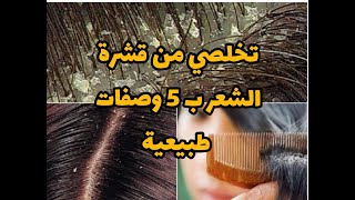 التخلص من قشرة الشعر ب5 وصفات طبيعية