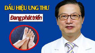Nếu bàn chân xuất hiện 3 dấu hiệu này ung thư đang phát triển trong cơ thể - Sống Khỏe