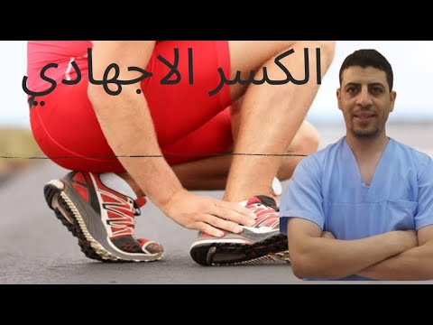 فيديو: كيفية علاج كسر الإجهاد: 10 خطوات (بالصور)