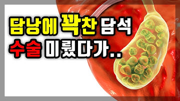 담석 수술 미뤘다가 결국! ｜담석으로 꽉찬 담낭 제거수술 이야기