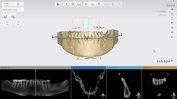 3Shape Implant Studio - Recorte de tomografias e Definição da curva panorâmica