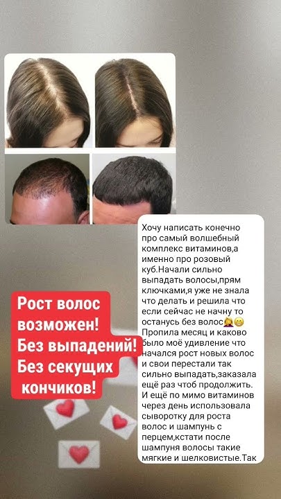 Куб для волос! Самые эффективные витамины для волос! - YouTube