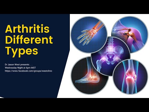 Free Arthritis Master