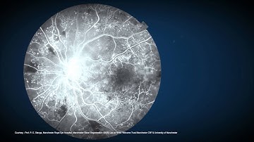 DRI OCT TRITON (Тopcon)