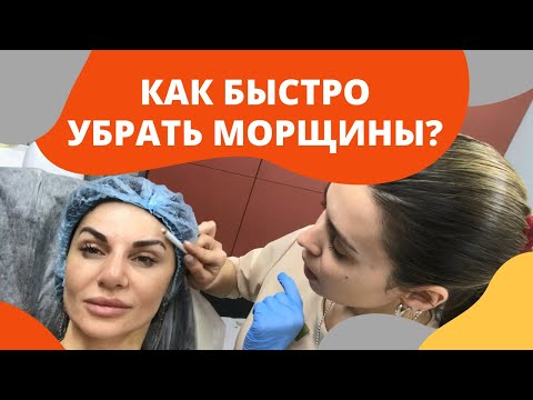 Как быстро убрать морщины. Видео уколов ботокса в косметологической клинике.