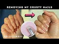 How to remove 5 week old gel x nails at home  cheap  easy removal