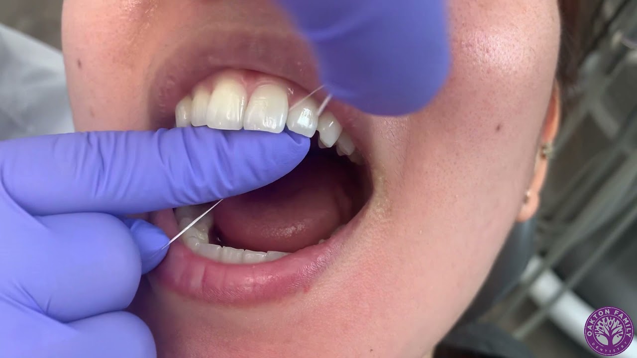 How to Floss 101: Quick Tip - YouTube