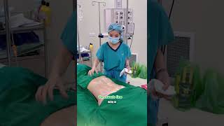 Abdominal Liposuction & Etching 🔥 Feminine 3-Line Definition | Sculpted Body Design