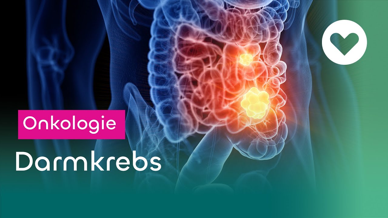 Darmkrebs - Symptome, Diagnose und Behandlung - YouTube