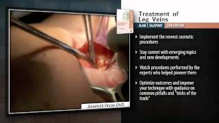 Procedures in Cosmetic Dermatology: Treatment of Leg Veins