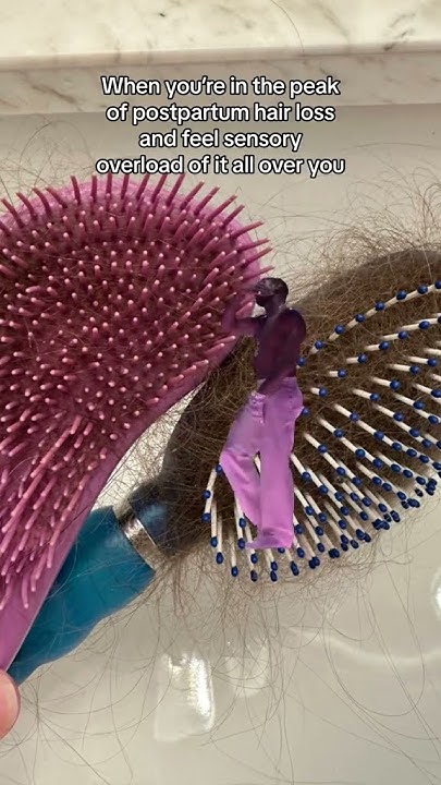 when-you-re-in-the-peak-of-postpartum-hair-loss-postpartum