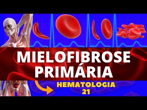 Video: Vai mielofibroze ietekmē acis?