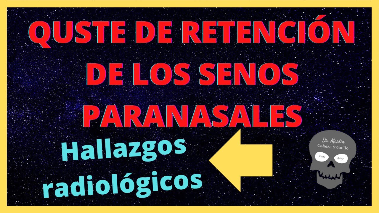 QUISTE DE RETENCIÓN de los SENOS PARANASALES 👃(Hallazgos Radiológicos)