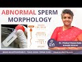 Abnormal sperm morphology  male infertility  dr chekuri suvarchala  ziva fertility