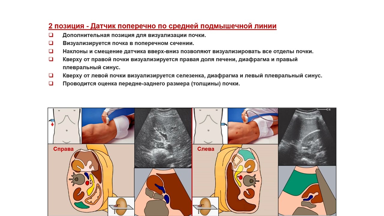 Ультразвуковая диагностика (УЗИ). Доктор Иогансен. Выпуск 68. Методика УЗИ почек.