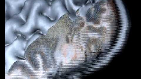 Exploring brain connectivity - Diffusion Tensor Imaging