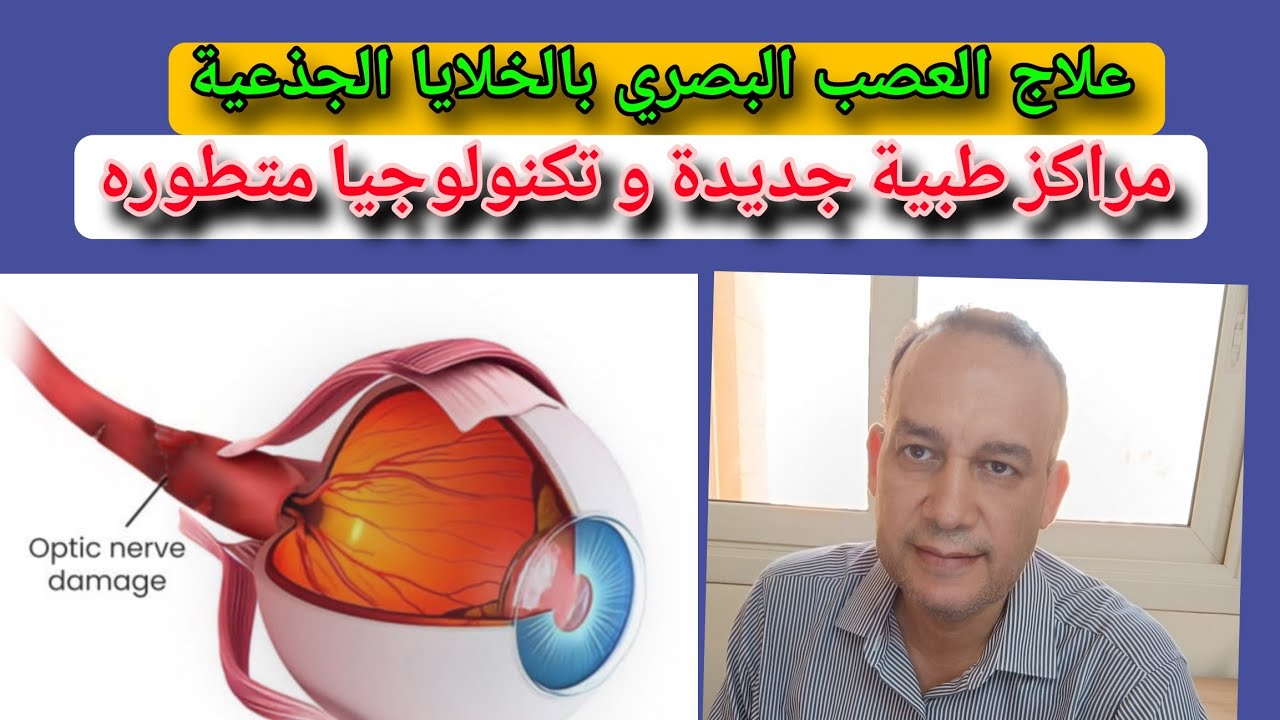 Использование стволовых клеток в современных центрах лечения атрофии зрительного нерва